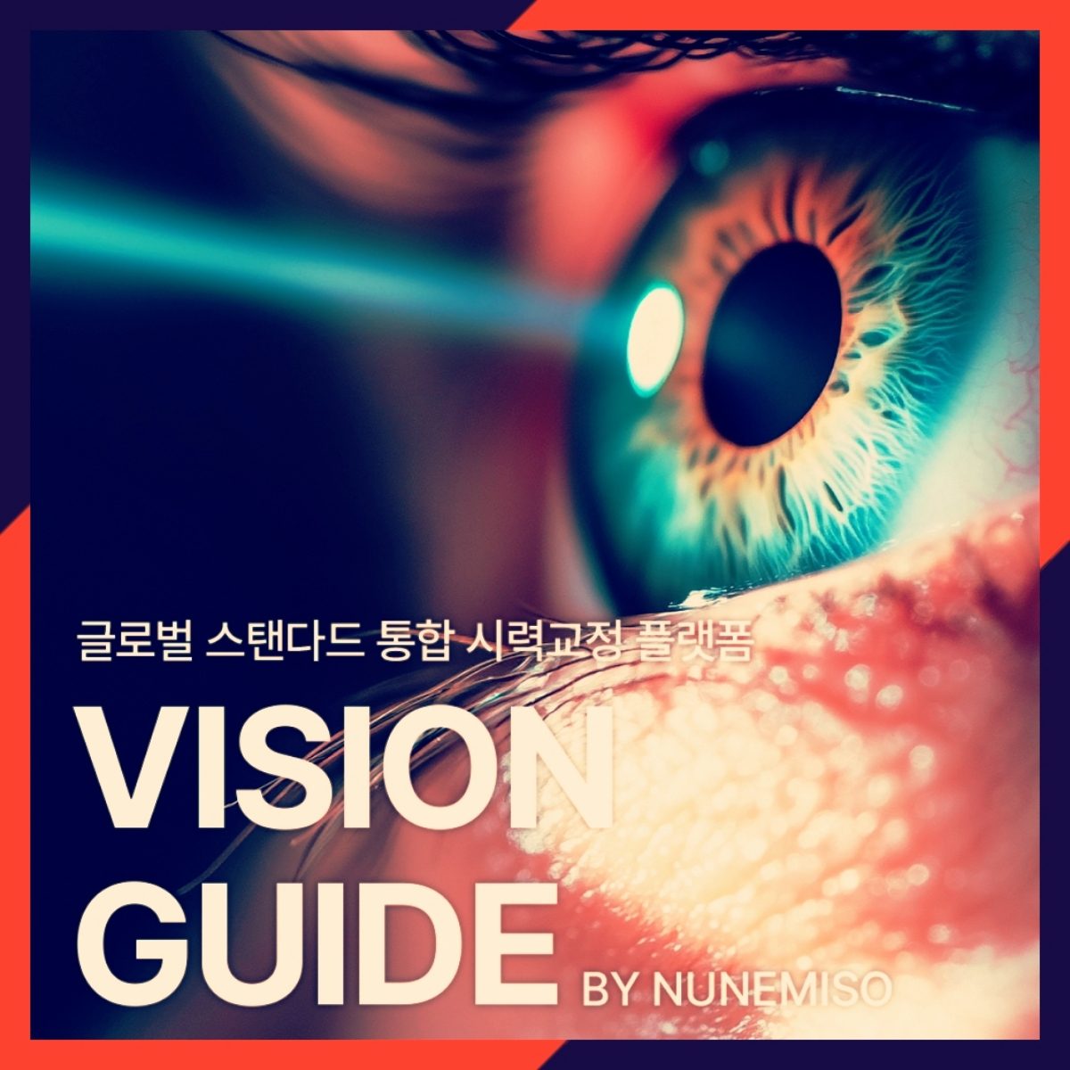 스마일프로 눈에미소안과